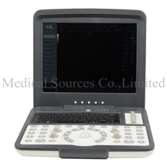 (MS-5600) Scanner à ultrasons pour ordinateur portable médical Doppler couleur Portabel 3D / 4D
