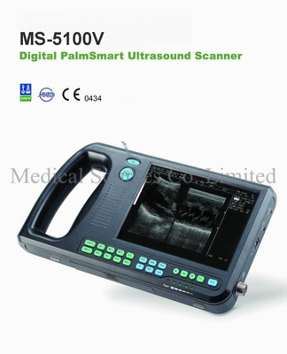 (MS-5100V) Scanner portable à ultrasons pour portable vétérinaire numérique Palmsmart